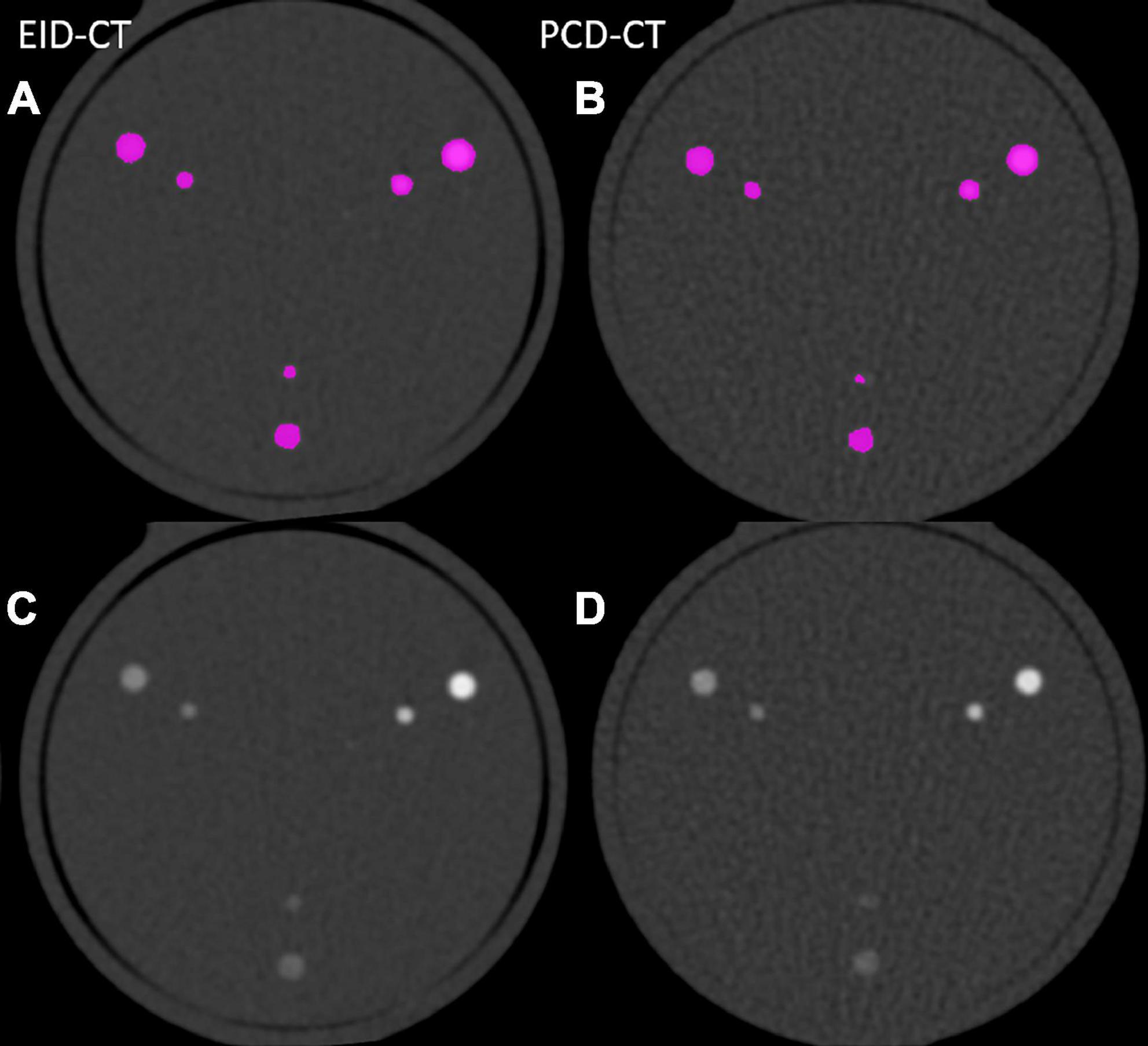 Intra-individual comparison of coronary calcium scoring between photon counting detector- and energy integrating detector-CT: Effects on risk reclassification